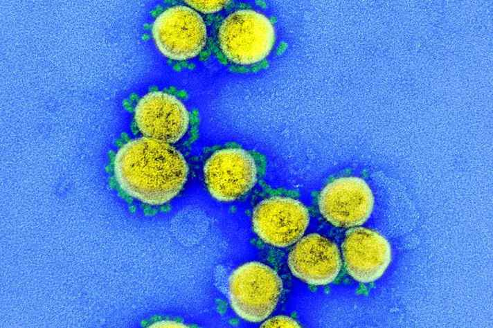 CTVacinas-UFMG detecta nova linhagem da variante ômicron no Brasil