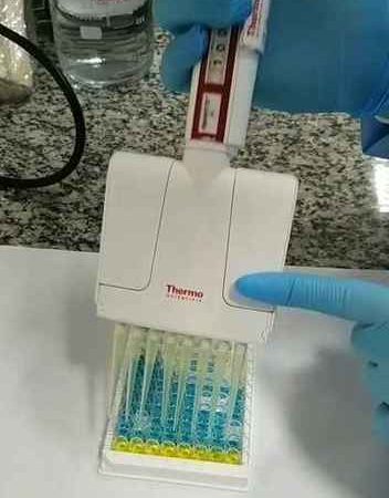 Tecnologia para o diagnóstico da covid-19, criada por grupo da UFMG, é tema de artigo da Science Advances