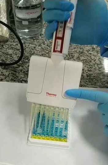 Tecnologia para o diagnóstico da covid-19, criada por grupo da UFMG, é tema de artigo da Science Advances