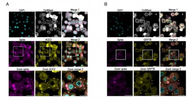 Vírus da COVID-19 infecta o fígado, estimulando a produção de glicose e agravando o quadro clínico