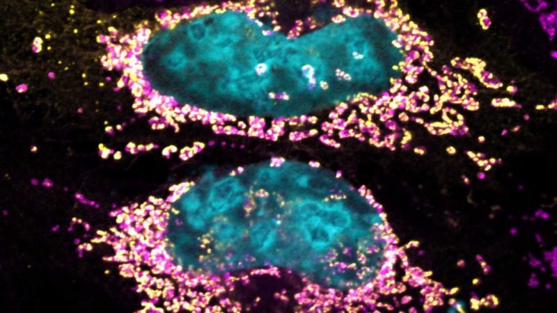 Estudo revela proteína bacteriana capaz de manter a célula humana saudável por mais tempo