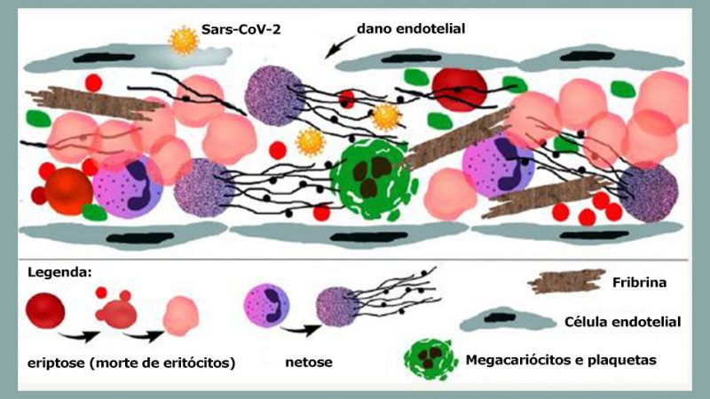 Novo estudo comprova que a COVID-19 grave é uma doença trombótica