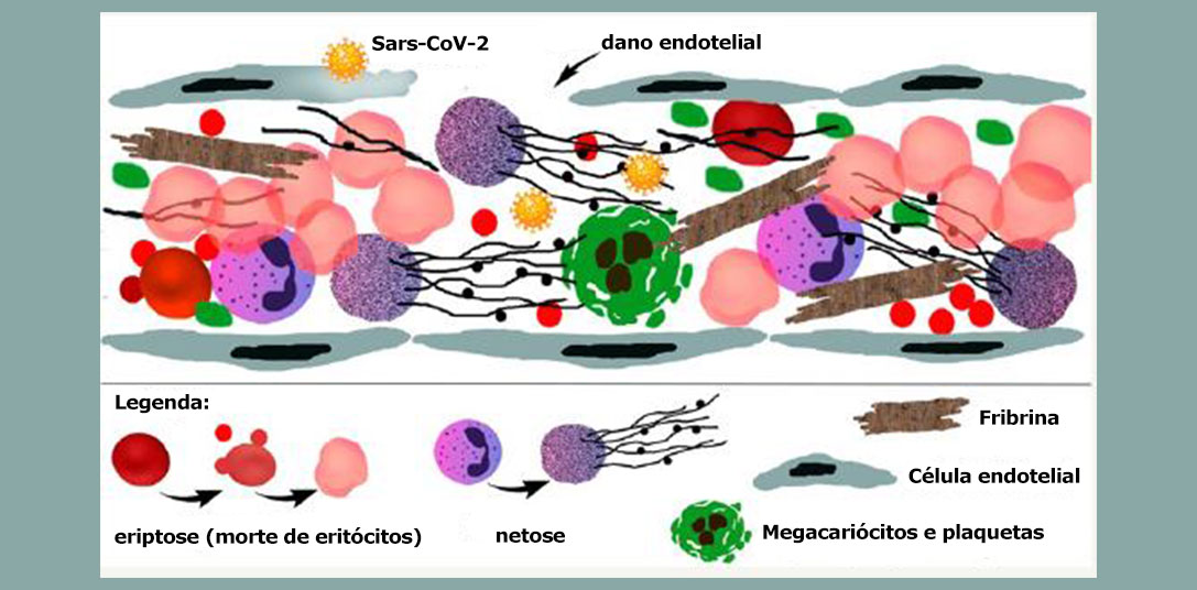 Novo estudo comprova que a COVID-19 grave é uma doença trombótica