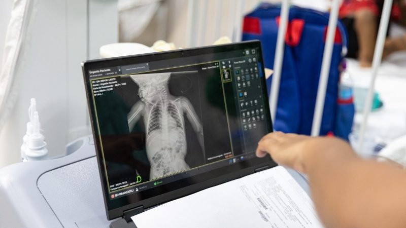 Prevenção e cuidados com sintomas das síndromes respiratórias
