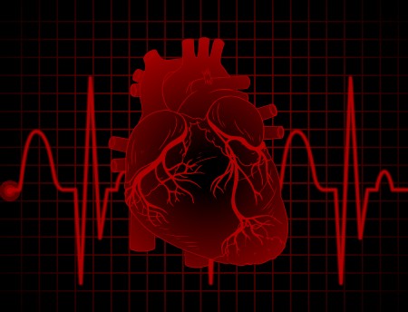 Variações dos níveis de glicose podem indicar gravidade de dano após infarto