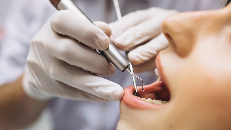 Dentista e clínica de Contagem devem indenizar paciente que perdeu dente e sofreu fratura