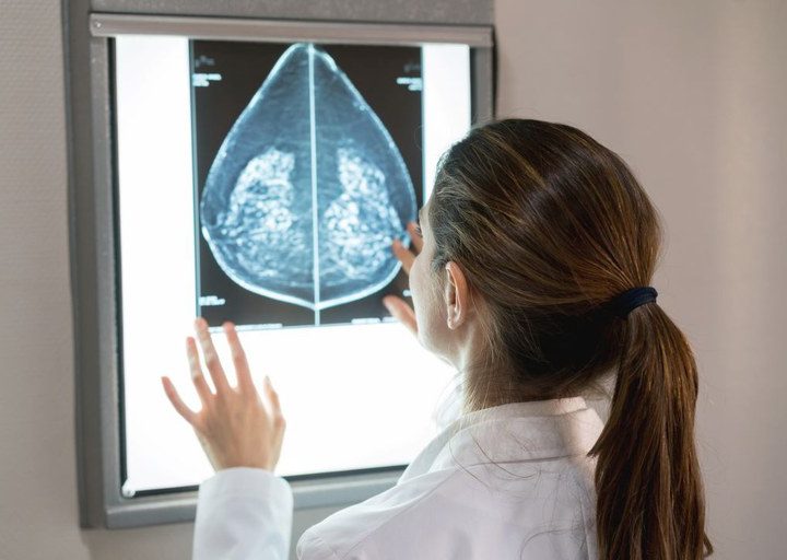 SUS amplia acesso à mamografia a mulheres de 40 a 49 anos