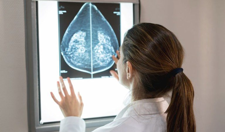 SUS amplia acesso à mamografia a mulheres de 40 a 49 anos