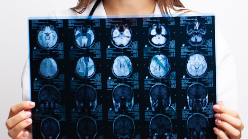 Tribunal mantém obrigação de operadora de planos de saúde de custear tratamento específico de fisioterapia