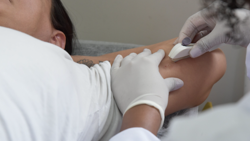 Saúde capacita médicos de família para ampliar acesso ao Implanon (método contraceptivo hormonal de longa duração)